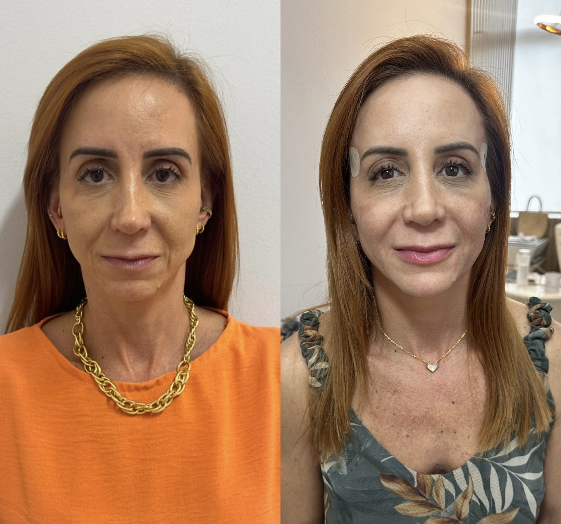 Resultado 2 de Fios de PDO