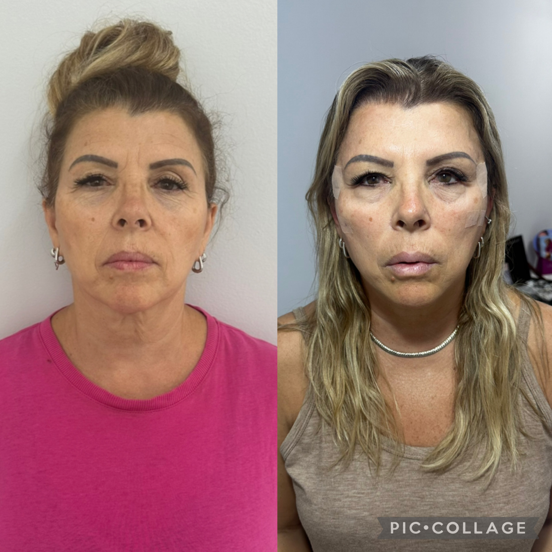 Resultado 3 de Fios de PDO